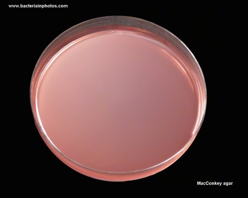 MacConkey agar plate
